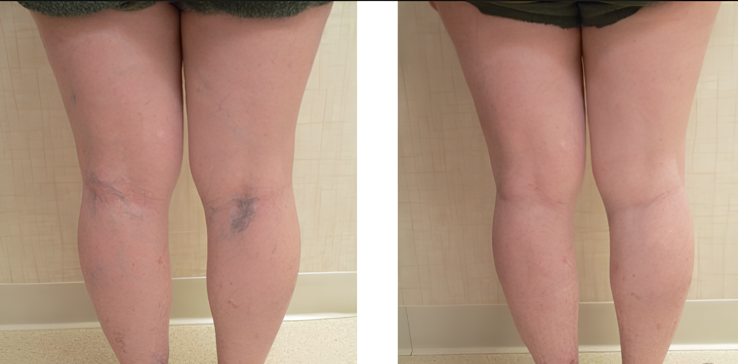 Antes e Depois (1) (1)