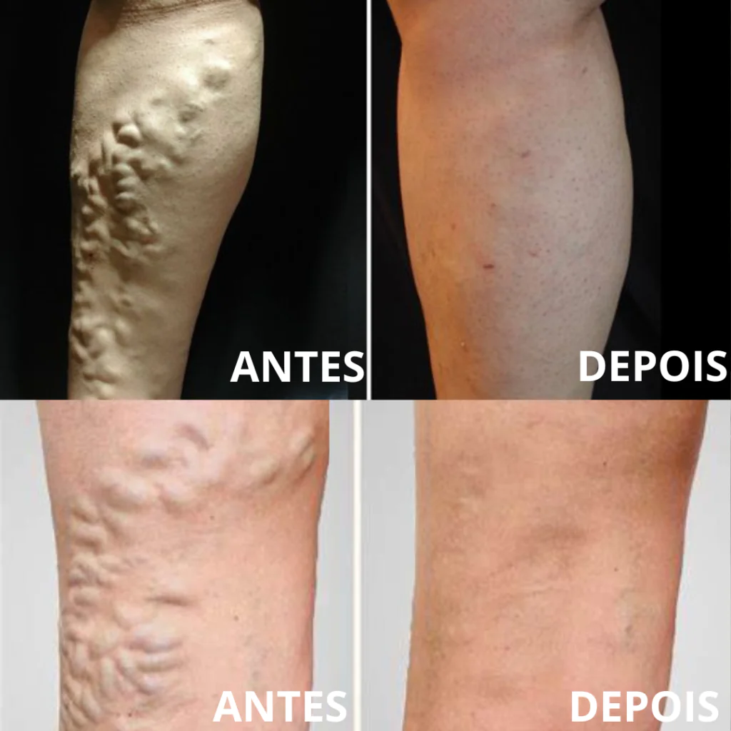 Antes e Depois (5) (1)
