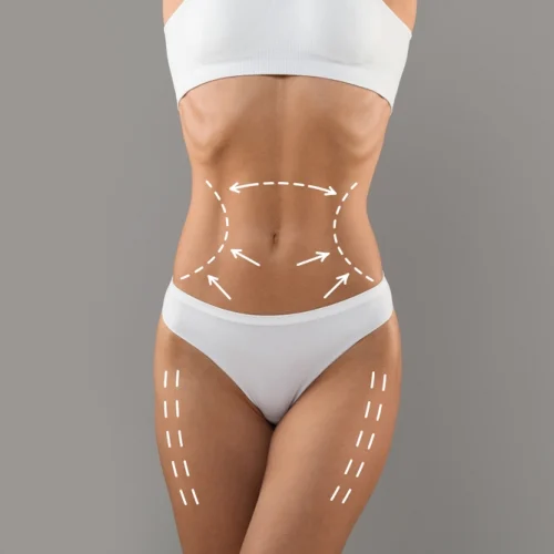 cirurgia-de-contorno-corporal