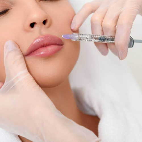 preco-do-preenchimento-labial